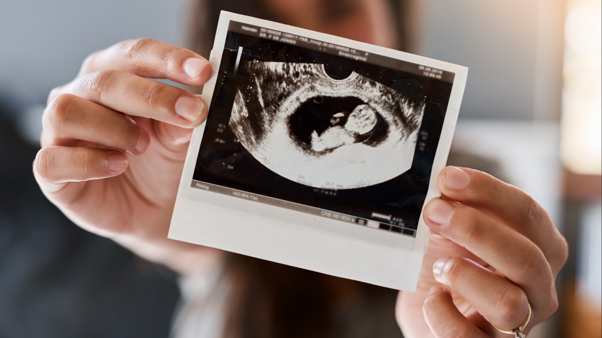iStock-1079702296 mom with ultrasound